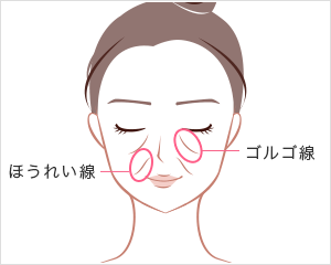 頬のしわ・たるみ、ほうれい線