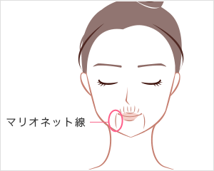 口元のしわ