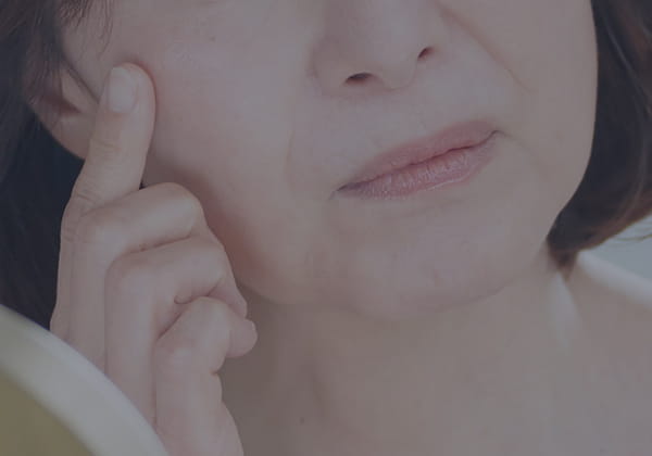 しわ・たるみ
