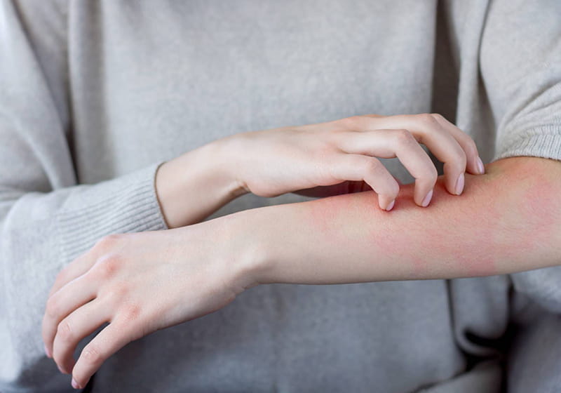 肌が弱く敏感な方・皮膚病をお持ちの方