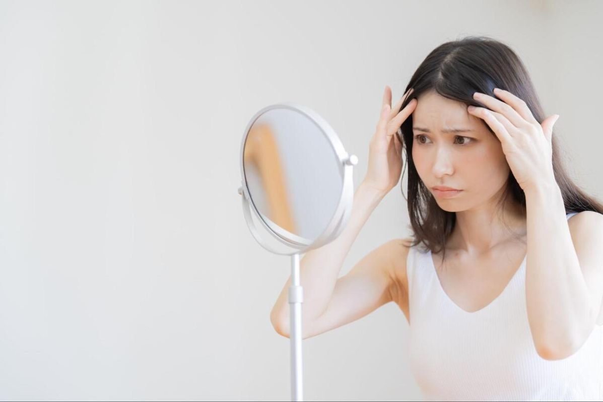 おでこのシミを治したい！原因と種類・改善策や予防法と治療についても解説