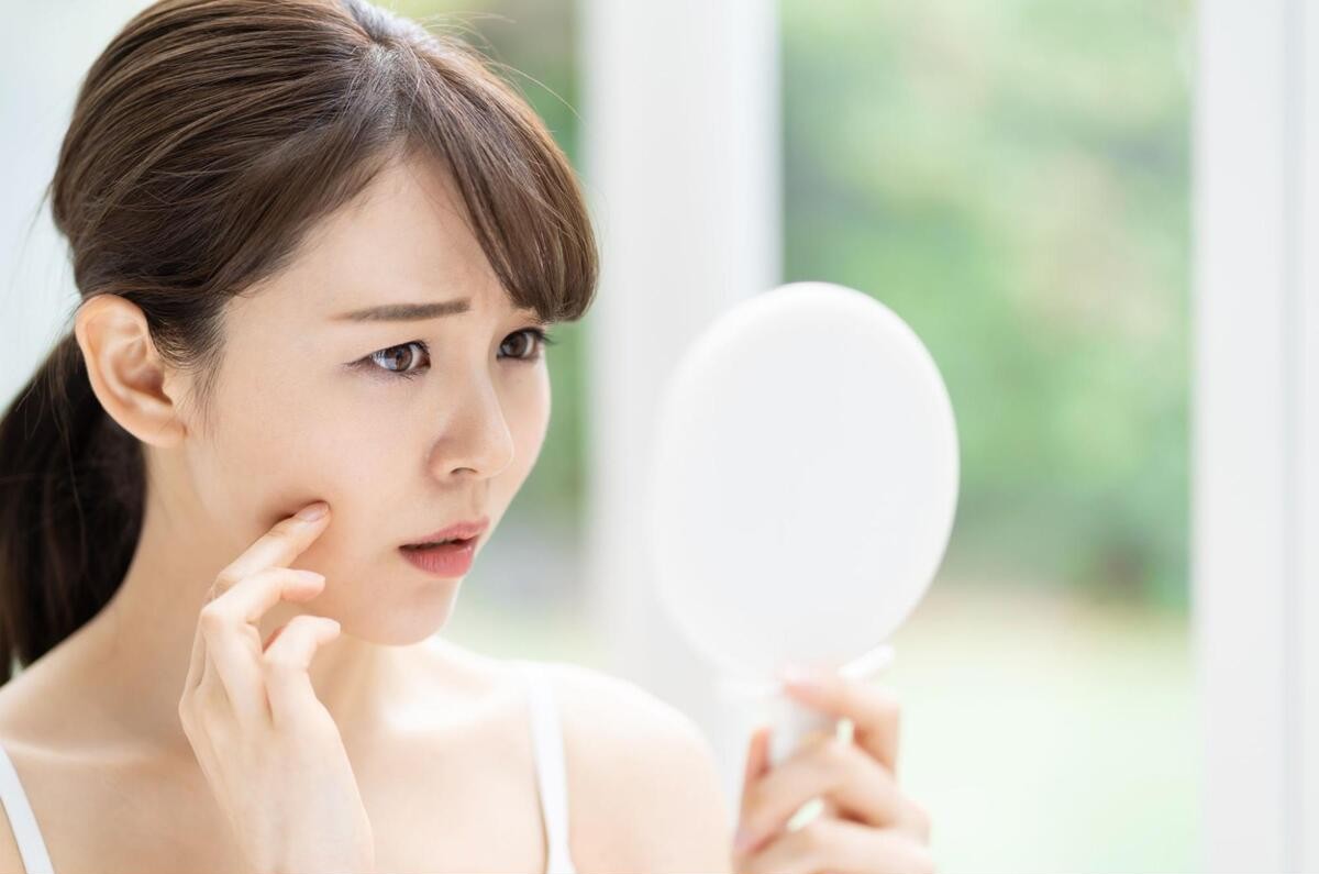 ニキビの白い塊を鏡で確認する女性