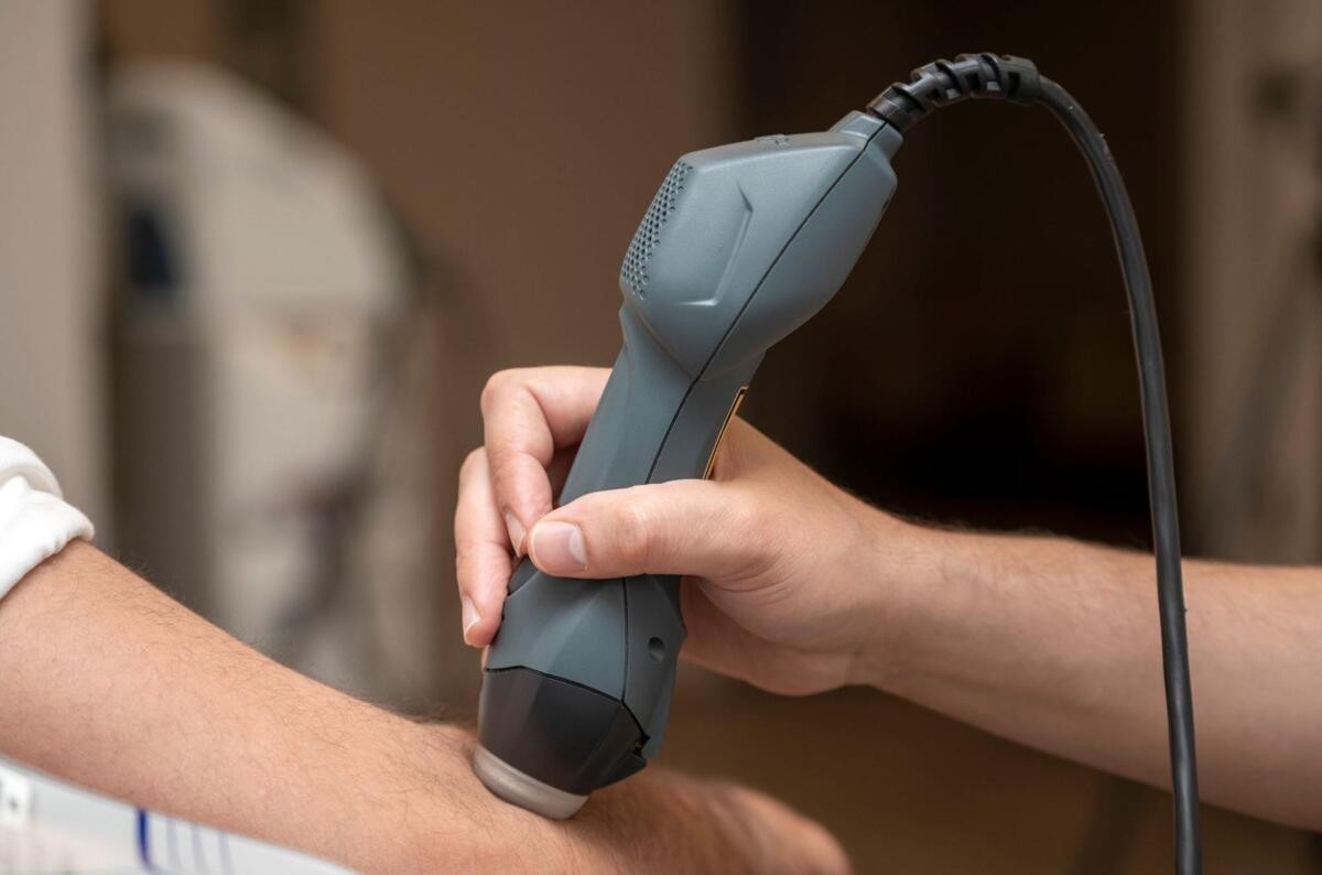 美容皮膚科であざの治療を受けている様子