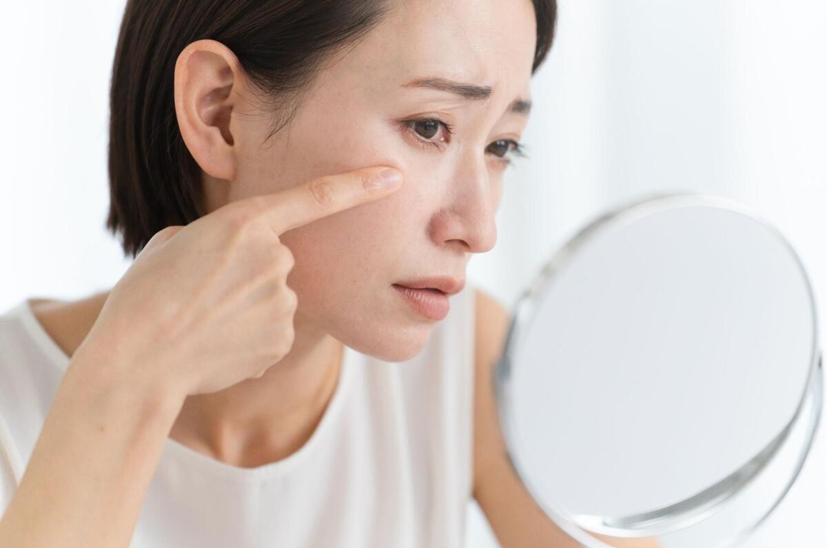 シミを取りたい!原因と種類・顔のシミを取る治療法と予防策も解説