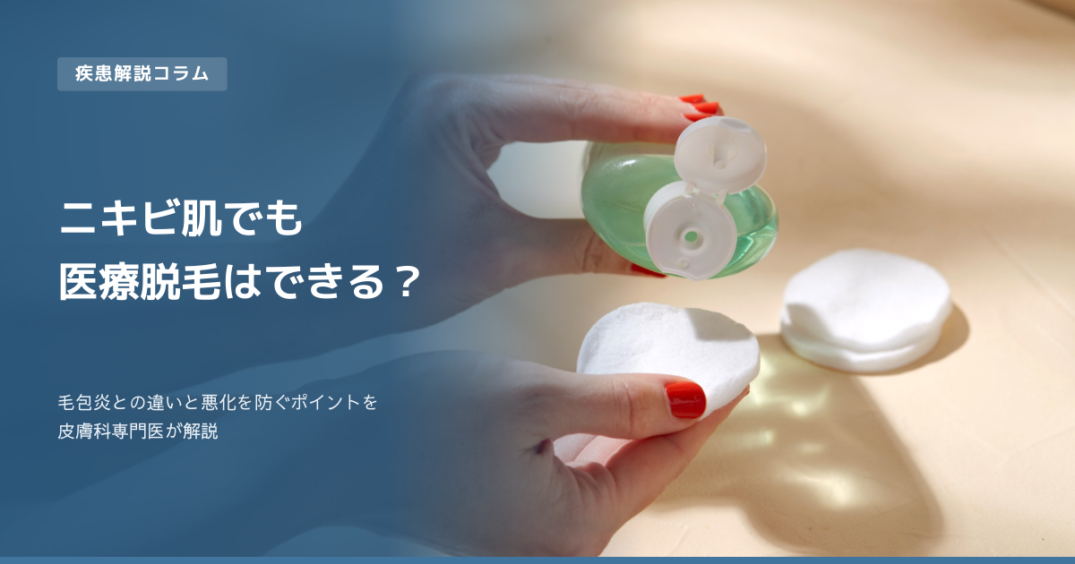 ニキビ・肌荒れがあっても医療脱毛はできる？毛包炎との違いと悪化を防ぐポイントを皮膚科専門医が解説