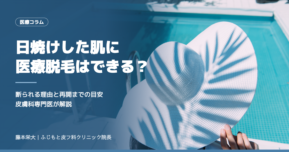 日焼けした肌に医療脱毛はできる？断られる理由と再開までの目安を皮膚科専門医が解説